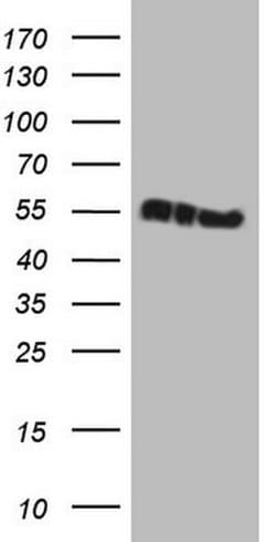 KRT16 Monoclonal Antibody (OTI2E6), TrueMAB , OriGene 30 &mu;L; Unconjugated:Antibodies,