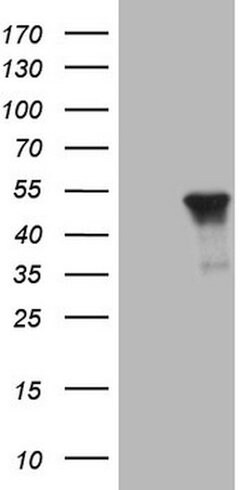 KRT16 Mouse anti-Human, Clone: OTI1G1, lyophilized, TrueMAB 100 &mu;g;