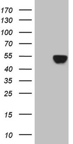 KRT16 Monoclonal Antibody (OTI6A11), TrueMAB , OriGene 100 &mu;L; Unconjugated:Antibodies,
