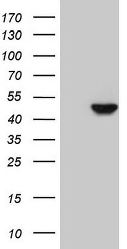 KRT16 Monoclonal Antibody (OTI2H8), TrueMAB , OriGene 30 &mu;L | Buy Online | Origene Technologies | Fisher Scientific