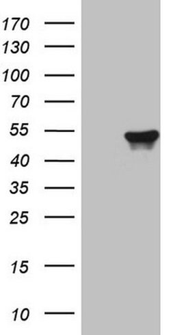 KRT16 Monoclonal Antibody (OTI7A4), TrueMAB , OriGene 100 &mu;L; Unconjugated:Antibodies,