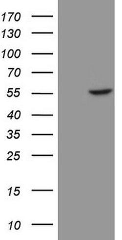 KRT16 Mouse anti-Human, Clone: OTI2F10, lyophilized, TrueMAB 100 &mu;g;