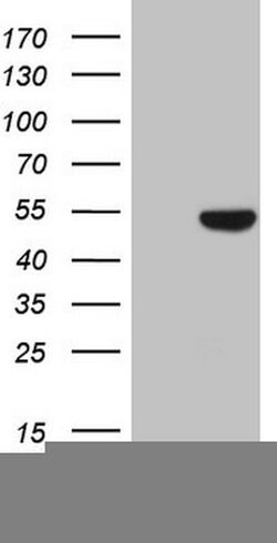 KRT16 Mouse anti-Human, Clone: OTI1G5, lyophilized, TrueMAB 100 &mu;g;