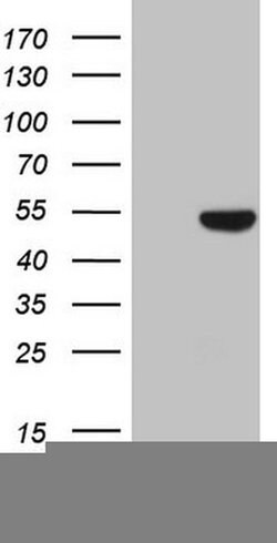 KRT16 Monoclonal Antibody (OTI1G5), TrueMAB , OriGene 100 &mu;L; Unconjugated:Antibodies,