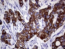 KRT18 Mouse anti-Human, Clone: OTI1E1, liquid, TrueMAB 100 &mu;L; Unconjugated:Antibodies,