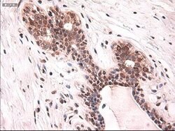 KRT18 Mouse anti-Canine, Human, Clone: OTI5E8, lyophilized, TrueMAB 100