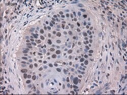 KRT18 Mouse anti-Canine, Human, Clone: OTI5E8, lyophilized, TrueMAB 100
