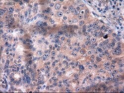 KRT18 Mouse anti-Canine, Human, Clone: OTI5E8, lyophilized, TrueMAB 100