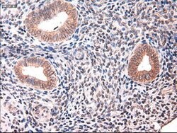 KRT18 Mouse anti-Canine, Human, Clone: OTI5E8, lyophilized, TrueMAB 100