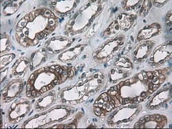 KRT18 Mouse anti-Canine, Human, Clone: OTI5E8, lyophilized, TrueMAB 100