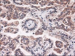 KRT18 Mouse anti-Canine, Human, Clone: OTI5E8, lyophilized, TrueMAB 100