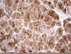 KRT18 Monoclonal Antibody (OTI2H10), TrueMAB , OriGene 100 &mu;L; Unconjugated:Antibodies,