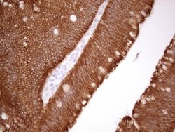 KRT18 Monoclonal Antibody (OTI2H10), TrueMAB , OriGene 100 &mu;L; Unconjugated:Antibodies,