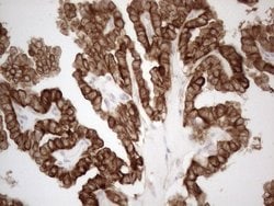 KRT18 Monoclonal Antibody (OTI2H10), TrueMAB , OriGene 100 &mu;L; Unconjugated:Antibodies,