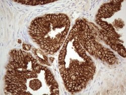 KRT18 Monoclonal Antibody (OTI2H10), TrueMAB , OriGene 100 &mu;L; Unconjugated:Antibodies,