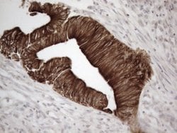 KRT18 Monoclonal Antibody (OTI2H10), TrueMAB , OriGene 100 &mu;L; Unconjugated:Antibodies,