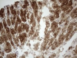 KRT18 Monoclonal Antibody (OTI2H10), TrueMAB , OriGene 100 &mu;L; Unconjugated:Antibodies,