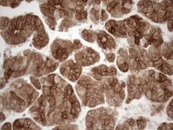 KRT18 Monoclonal Antibody (OTI2H10), TrueMAB , OriGene 100 &mu;L; Unconjugated:Antibodies,