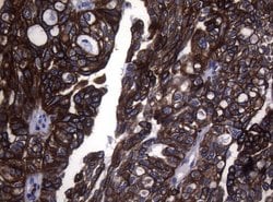 KRT18 Monoclonal Antibody (OTI5E4), TrueMAB , OriGene 100 &mu;L | Buy Online | Origene Technologies | Fisher Scientific