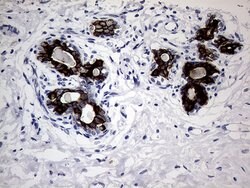 KRT18 Mouse anti-Human, Clone: OTI10H8, lyophilized, TrueMAB 100 &mu;g;