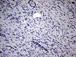 KRT18 Mouse anti-Human, Clone: OTI10H8, lyophilized, TrueMAB 100 &mu;g;