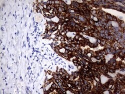 KRT18 Mouse anti-Human, Clone: OTI10H8, lyophilized, TrueMAB 100 &mu;g;