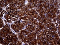 KRT18 Mouse anti-Human, Clone: OTI10H8, lyophilized, TrueMAB 100 &mu;g;