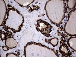 KRT18 Mouse anti-Human, Clone: OTI10H8, lyophilized, TrueMAB 100 &mu;g;