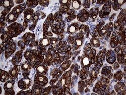 KRT18 Mouse anti-Human, Clone: OTI10H8, lyophilized, TrueMAB 100 &mu;g;