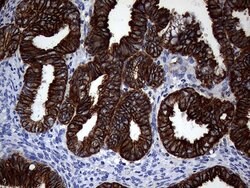 KRT18 Mouse anti-Human, Clone: OTI10H8, lyophilized, TrueMAB 100 &mu;g;
