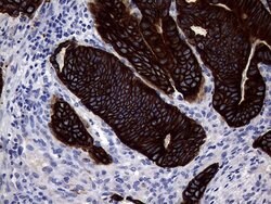 KRT18 Mouse anti-Human, Clone: OTI10H8, lyophilized, TrueMAB 100 &mu;g;