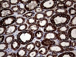 KRT18 Mouse anti-Human, Clone: OTI10H8, lyophilized, TrueMAB 100 &mu;g;