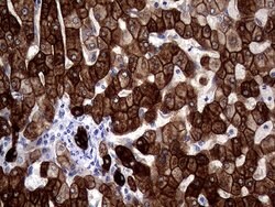 KRT18 Mouse anti-Human, Clone: OTI10H8, lyophilized, TrueMAB 100 &mu;g;