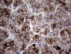 KRT18 Mouse anti-Human, Clone: OTI10H8, lyophilized, TrueMAB 100 &mu;g;