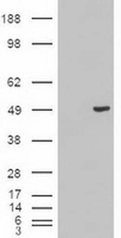 KRT18 Mouse anti-Human, Clone: OTI1E1, liquid, TrueMAB 100 &mu;L; Unconjugated:Antibodies,
