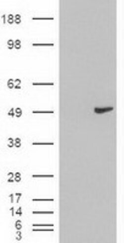 KRT18 Mouse anti-Canine, Human, Clone: OTI5E8, lyophilized, TrueMAB 100