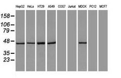KRT18 Mouse anti-Canine, Human, Clone: OTI5E8, lyophilized, TrueMAB 100