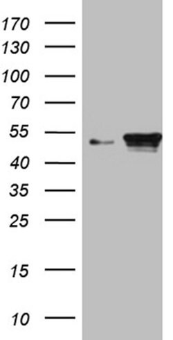 KRT18 Mouse anti-Human, Clone: OTI10H8, lyophilized, TrueMAB 100 &mu;g;