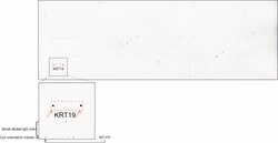 KRT19 Mouse anti-Human, Clone: UMAB187, lyophilized, UltraMAB 100 &mu;g | Buy Online | OriGene | Fisher Scientific