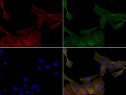 KRT19 Mouse anti-Canine, Human, Clone: UMAB3, liquid, UltraMAB 100 &mu;L | Buy Online | Origene Technologies | Fisher Scientific