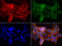 KRT19 Mouse anti-Human, Clone: UMAB187, lyophilized, UltraMAB 100 &mu;g | Buy Online | OriGene | Fisher Scientific