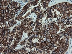 KRT19 Mouse anti-Canine, Human, Rat, Clone: OTI3F8, lyophilized, TrueMAB