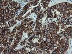 KRT19 Mouse anti-Canine, Human, Rat, Clone: OTI3F8, liquid, TrueMAB 100