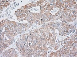 KRT19 Mouse anti-Canine, Human, Rat, Clone: OTI3F8, liquid, TrueMAB 100