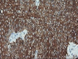 KRT19 Mouse anti-Canine, Human, Rat, Clone: OTI3F8, lyophilized, TrueMAB