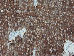 KRT19 Mouse anti-Canine, Human, Rat, Clone: OTI3F8, liquid, TrueMAB 100
