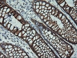 KRT19 Mouse anti-Canine, Human, Rat, Clone: OTI3F8, liquid, TrueMAB 100