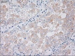 KRT19 Mouse anti-Human, Clone: OTI4E12, liquid, TrueMAB 100 &mu;L | Buy Online | Origene Technologies | Fisher Scientific