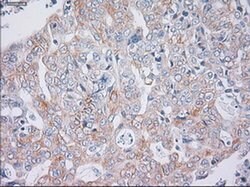 KRT19 Mouse anti-Human, Clone: OTI4E12, liquid, TrueMAB 100 &mu;L | Buy Online | Origene Technologies | Fisher Scientific