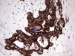 KRT19 Monoclonal Antibody (OTI1F5), TrueMAB , OriGene 100 &mu;L; Unconjugated:Antibodies,